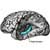 The Mysteries of Amnesia