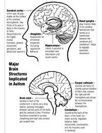 Autism Autistic Brain Sall Ann Test